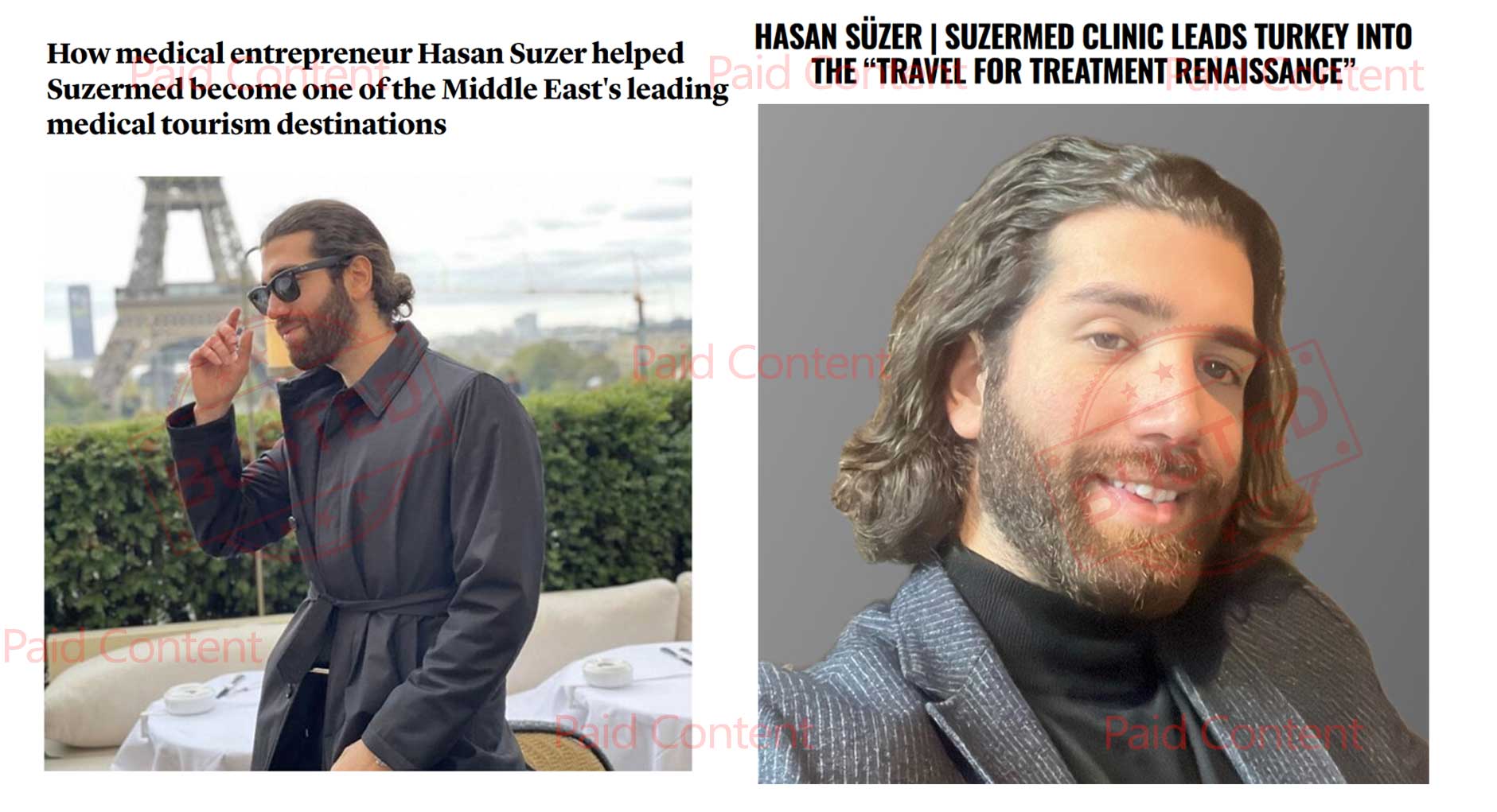 Hasan-Suzer-Suzermed-Clinic